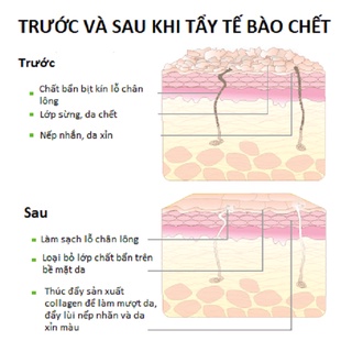 Tẩy tế bào chết Jsaem