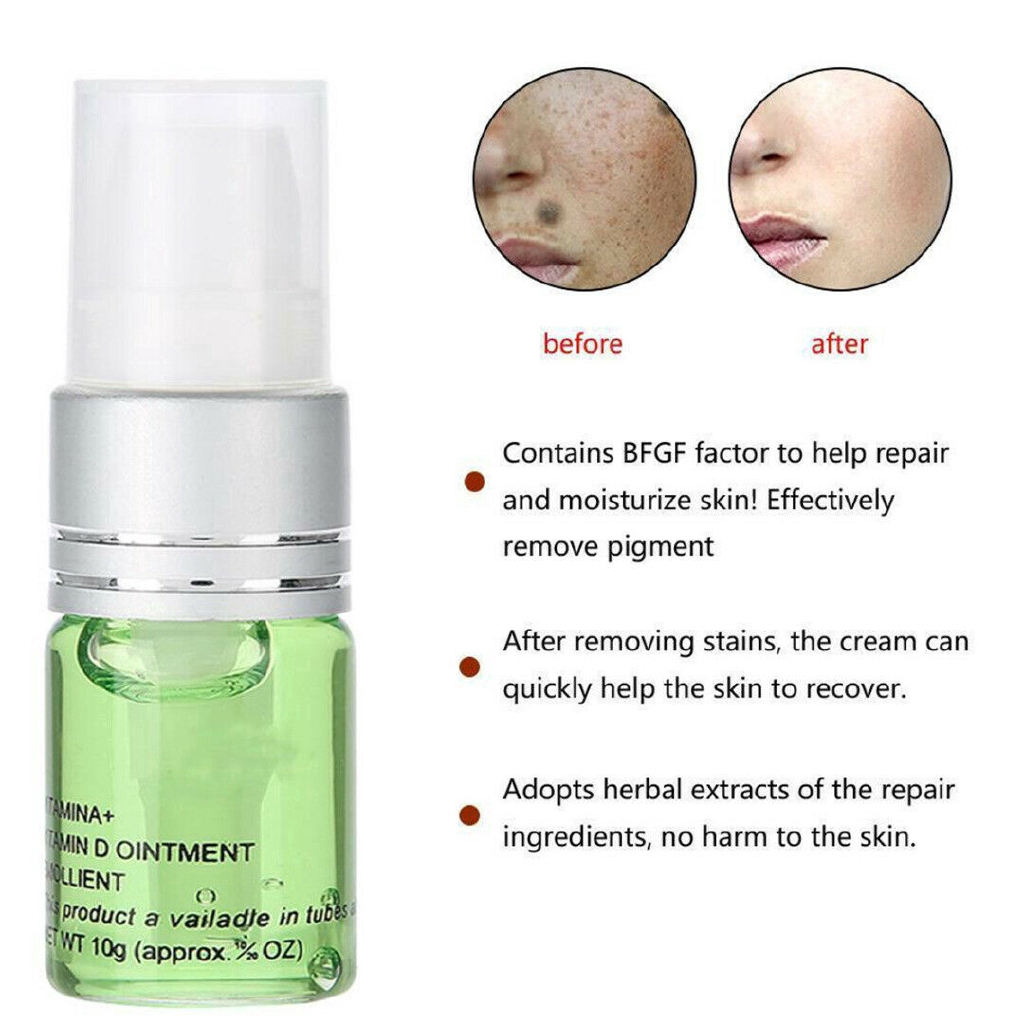 [Hàng mới về] Kem lô hội xóa tàn nhang không gây đau an toàn cho da