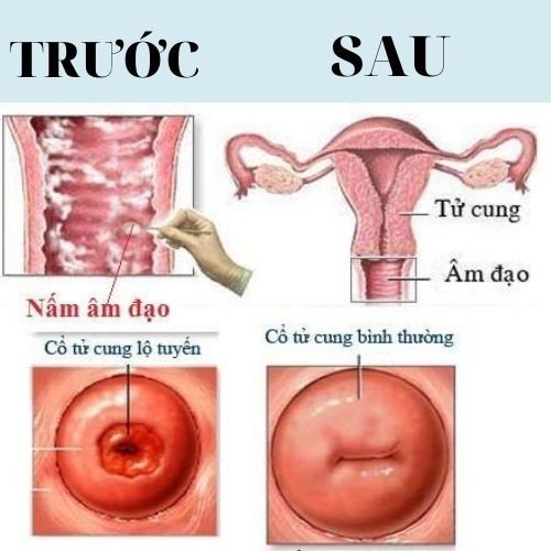 Bột rửa phụ khoa CAO CẤP Cổ dược Kỳ Hoa - Bảo vệ sức khỏe cô bé