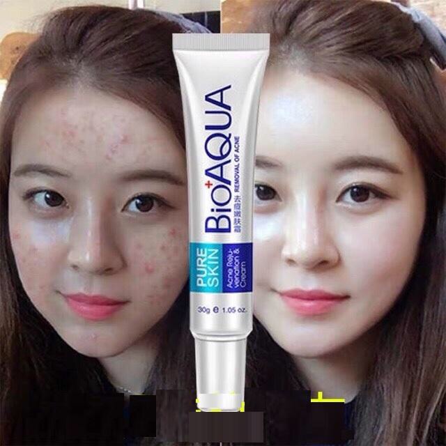 Kem Mụn Bioaqua Pure Skin Hàng Nội Địa Trung