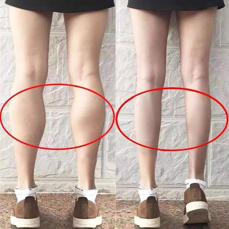 Gen thon bắp chân , nịt bắp chân thon gọn ( combo 1 đôi đai )
