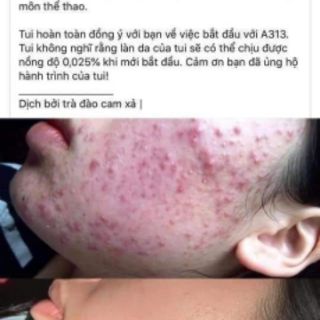 Kem dưỡng ẩm Retinol A313 (có bill)