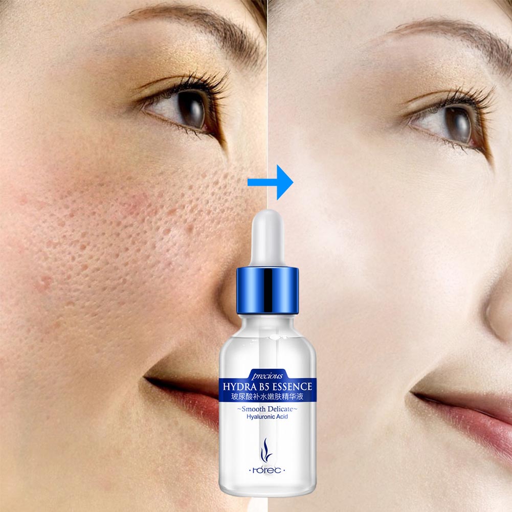 (Hàng Mới Về) Tinh Chất Axit Hyaluronic Giúp Nâng Cơ Mặt Và Chống Lão Hóa Hiệu Quả | BigBuy360 - bigbuy360.vn