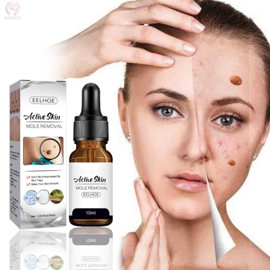 Tinh Chất Hỗ Trợ Giảm Mụn Cóc Cho Vùng Da Cổ / Chân / Bắp Dạng Lỏng 10ml TTLIFE