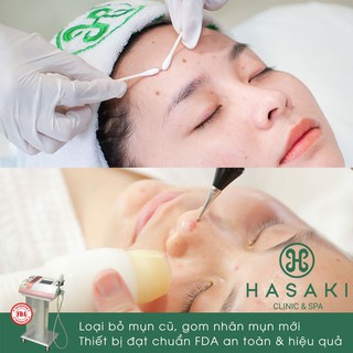 HCM [Voucher] - Combo Meso Mụn & Lấy Mụn Acne Serum Aqua Mesoderm & Pimple Removal