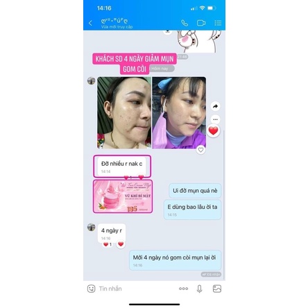 [Chính Hãng] Kem Face 2 Tầng Myô