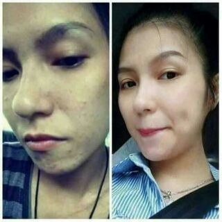 BỘT CÁM GẠO CAO CẤP.ANTHY