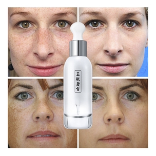 Tinh chất SOONPURE dưỡng ẩm giúp trắng da