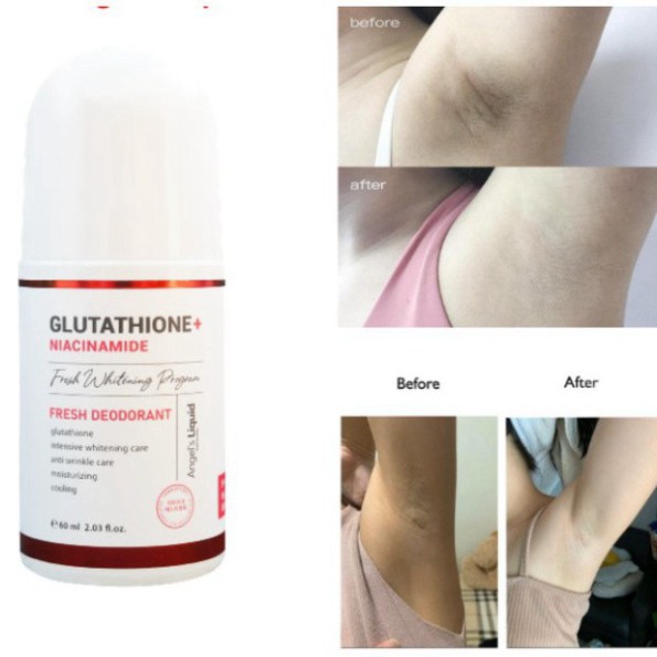 Lăn khử mùi Angel's Liquid Glutathione niacinamide fresh deodorant G5