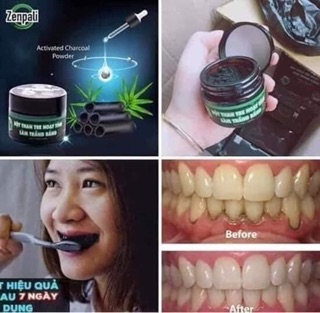 Bột trắng răng than hoạt tính zenpali