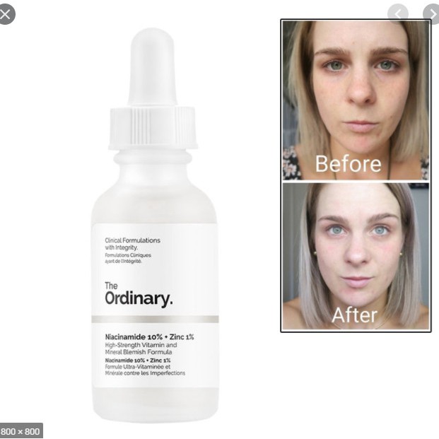 - Niacinamide 10% + Zinc 1% tinh chất ngừa mụn thâm The Ordinary