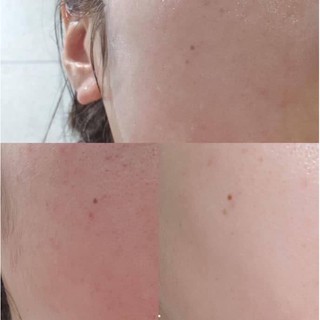 Mặt nạ- Dr.Althea squalane silk mask
