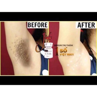 Serum mờ thâm Juihe ⚡𝗙𝗥𝗘𝗘 𝗦𝗛𝗜𝗣⚡_ hàng chuẩn