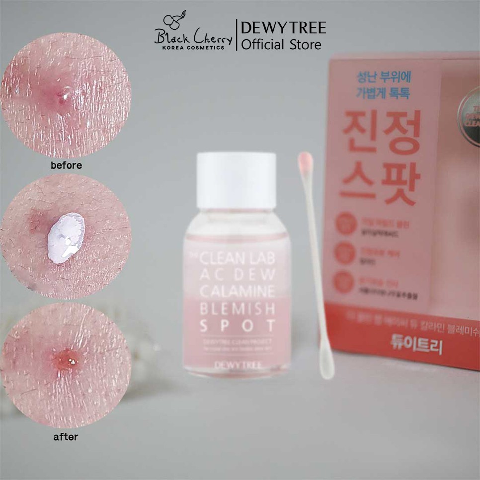Chấm mụn Dewytree The Clean Lab AC DEW Calamine Blemish Spot 20ml | BigBuy360 - bigbuy360.vn