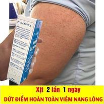 COMBO 2 CHAI MEN VI SINH TAVIDA HẾT MỤN LƯNG, VIÊM NANG LÔNG, MẨN NGỨA