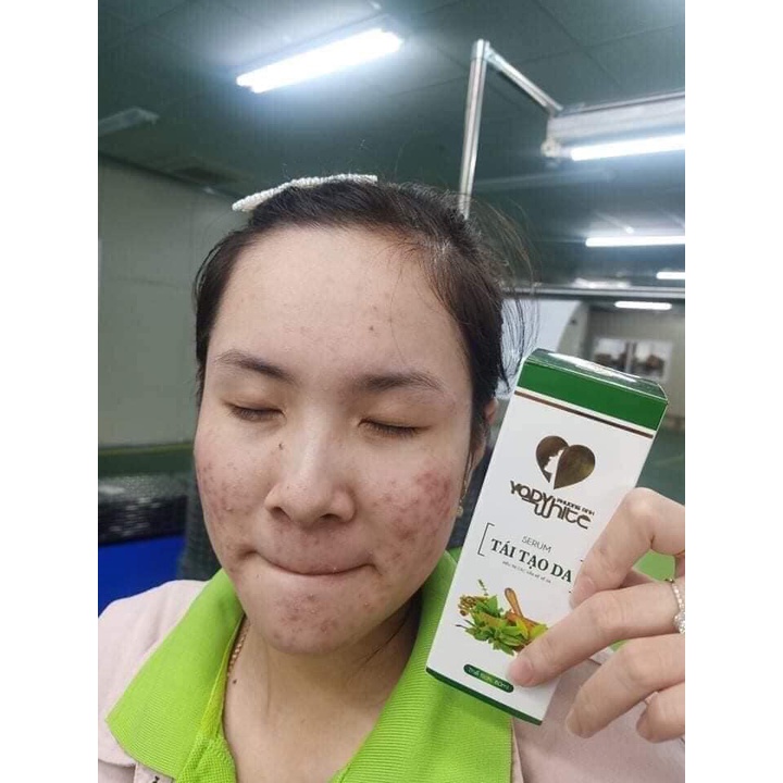 Serum tái tạo da Yody White Phương Anh