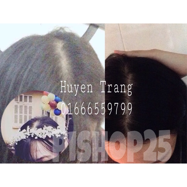 [MẪU MỚI] TINH DẦU BƯỞI MỌC TÓC CHÍNH HÃNG | BigBuy360 - bigbuy360.vn