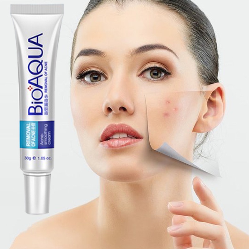 Kem giảm mụn,BIOAQUA, ngừa rạn da,sẹo, thâm,mụn lưng,mau lành vết thương, nam, nữ, tuổi dậy thì 30g hàng chính hãng.