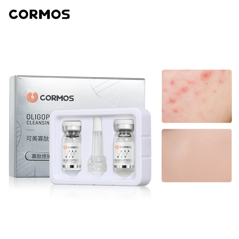 CORMOS oligopeptide clearing and repairing lyophilized powder set 1 pairs
