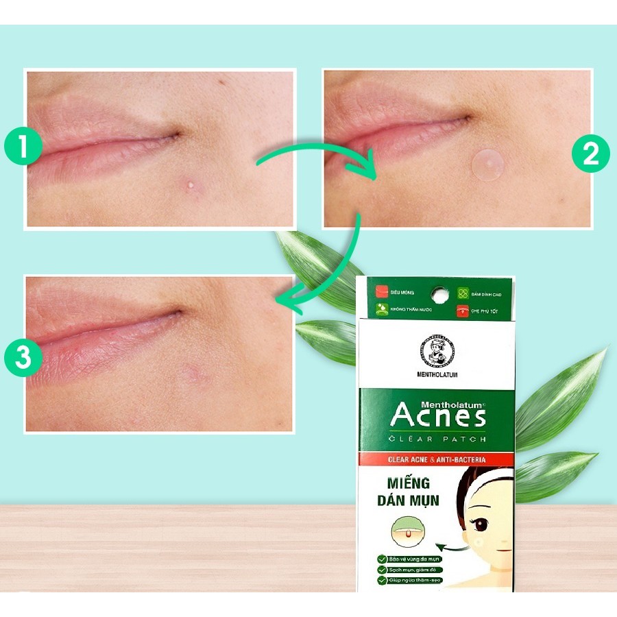 (12 miếng - hàng khuyến mãi) Miếng Dán Mụn Acnes Clear Patch | BigBuy360 - bigbuy360.vn