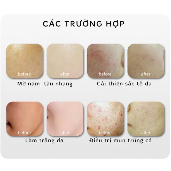 Vòm ánh sáng cảm ứng sinh học DEVOIR HÀN QUỐC - Spamall