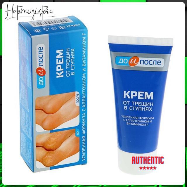 Kem dưỡng da tay chân [Hết nứt nẻ 100%-Hàng Auth] Kem chống nứt gót chân nga kpem foot cream 50ml