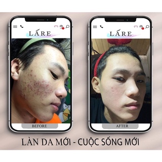 SERUM THANH DƯỢC LÁRE VER 2 50ml