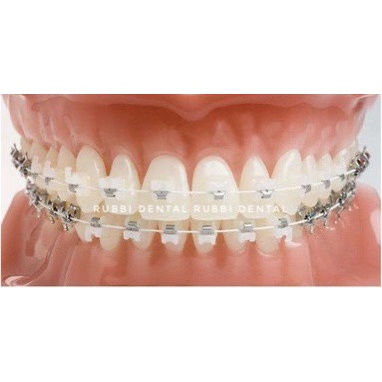 Mắc cài chỉnh nha sứ tự buộc hàng chính hãng - Tặng mắc cài răng 6, răng 7 và cây ấn