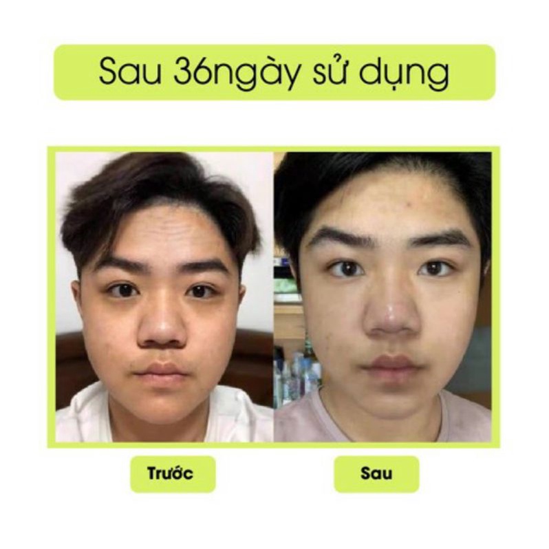 Kem Thâm Mắt Gấu Trúc Peiland 15gram