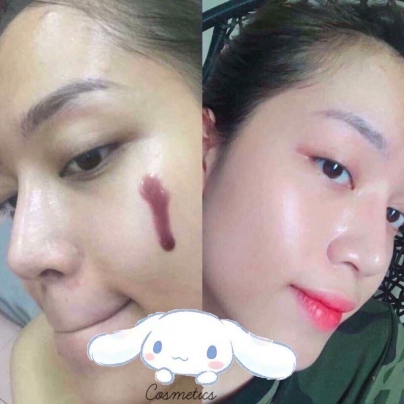 Red Peel Tingle Serum 35ml Tinh Chất Tái Tạo Da Chính Hãng | BigBuy360 - bigbuy360.vn