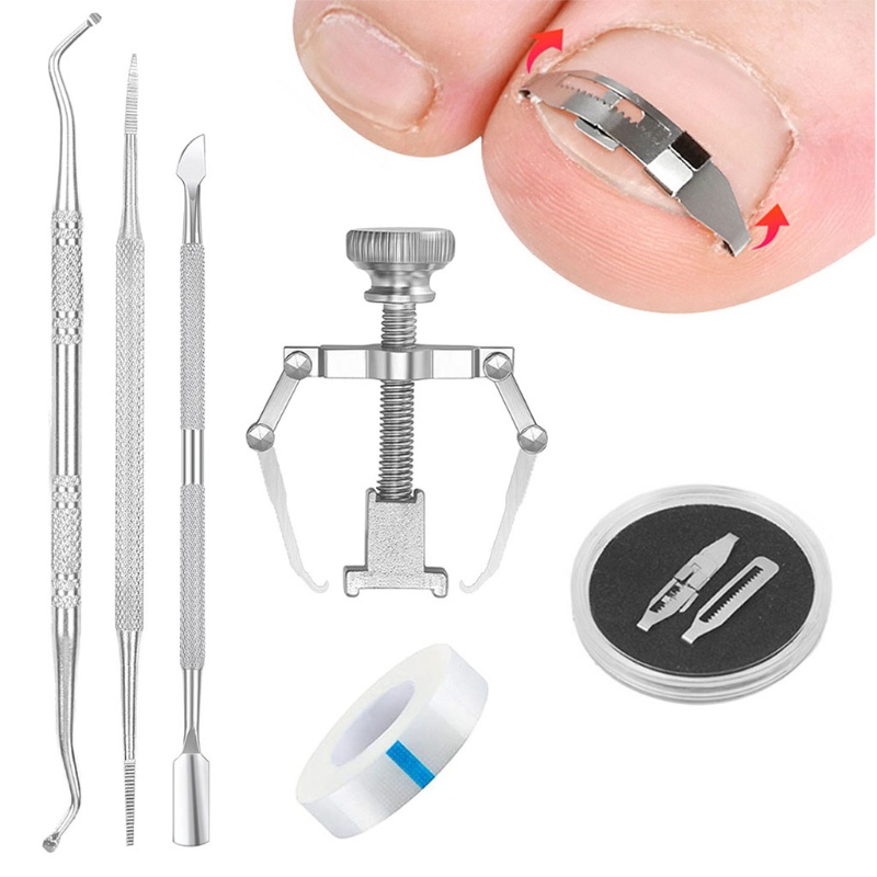 Bộ Dụng Cụ Chỉnh Sửa Móng Chân Mọc Ngược YOUYO Paronychia