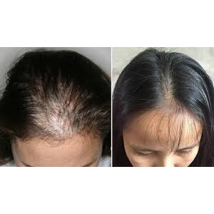 Cặp Gội Xả BƯỞI Giảm Rụng Tóc, Kích Thích Mọc Tóc CT53