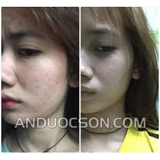 Combo An Dược Sơn Serum Và Bột Thảo Dược 30ml