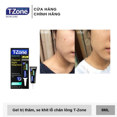 Gel giảm mụn và thâm cấp tốc T-ZONE | BigBuy360 - bigbuy360.vn