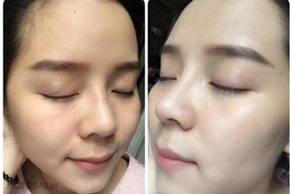 [SALE - TẾT] Serum Cấy Phấn Trắng Da Meso White