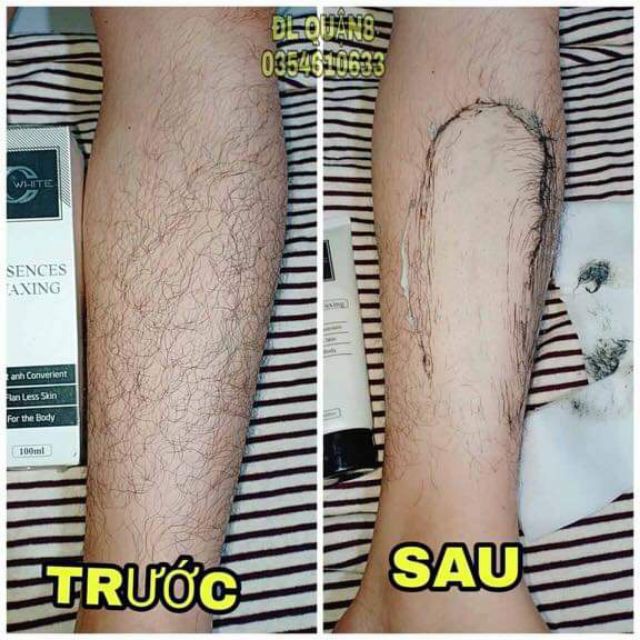 Freeship tẩy lông chân, tay, nách