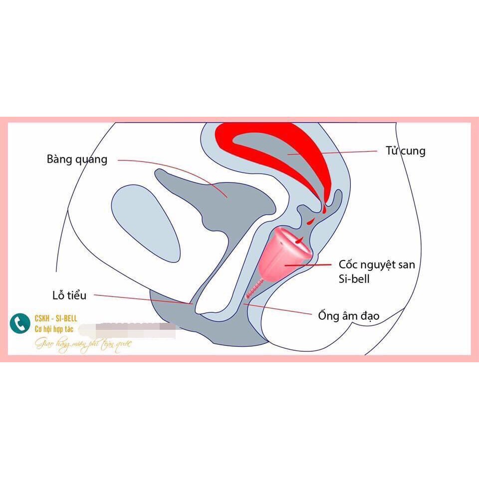 TẶNG CỐC TIỆT TRÙNG VÀ VIÊN TIỆT TRÙNG KHI MUA CỐC NGUYÊT SAN SIBEL - PHÁP