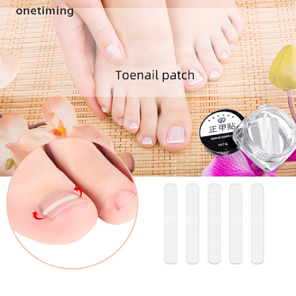 Bộ 10 Miếng Dán Đàn Hồi Chỉnh Sửa Móng Chân Mọc Ngược
