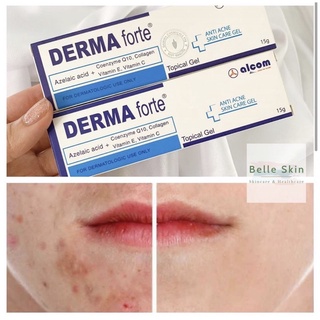 Kem mụn Derma Forte dưỡng da giảm mụn, giảm thâm, mờ sẹo 15g