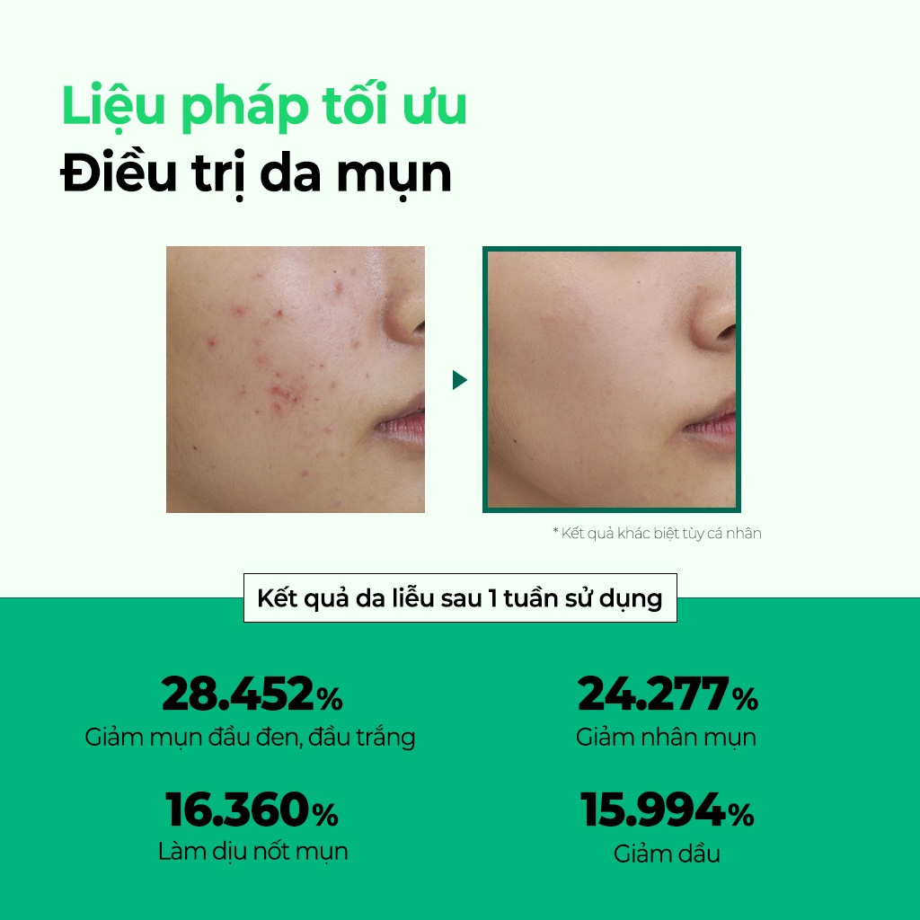 Kem chấm mụn chuyên sâu SOME BY MI cao cấp - Miracle AC Clear Spot Treatment 10g