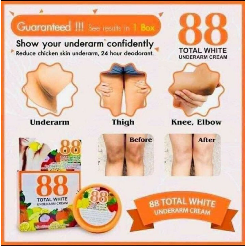 Kem giảm thâm 88 total white Thái lan