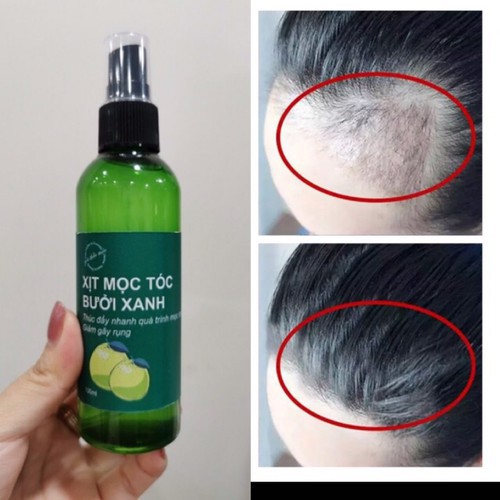 Chai xịt kích thích mọc tóc, tóc mọc nhanh sau 2 tuần, chiết xuất bưởi xanh an toàn cho da đầu