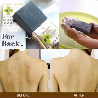 COMBO Xà Phòng + Xịt Mụn Lưng For back