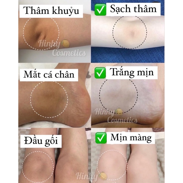 [Mã SKAMSALE8 giảm 10% đơn 200K] Gel Thâm Body Secret Key Snow White Spot Gel