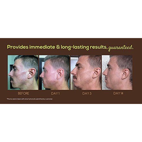 [MÃ FRIGBH111- 10% đơn 500K] Dấm táo Nhập khẩu Mỹ Organic Bragg có con dấm mẹ 473ml (Date 11.5.2023) | BigBuy360 - bigbuy360.vn