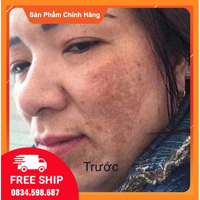 Bộ Meiya cam của Nhật