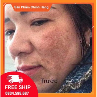 Bộ Meiya cam của Nhật