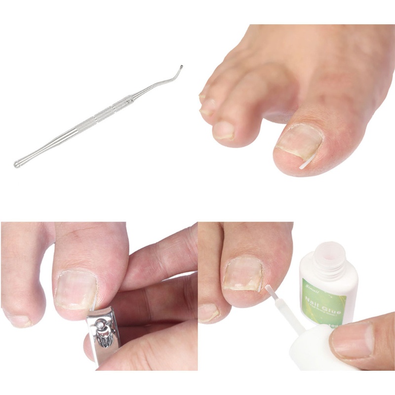 Set 10 Dụng Cụ Chỉnh Sửa Móng Chân Giúp Giảm Đau Tiện Dụng