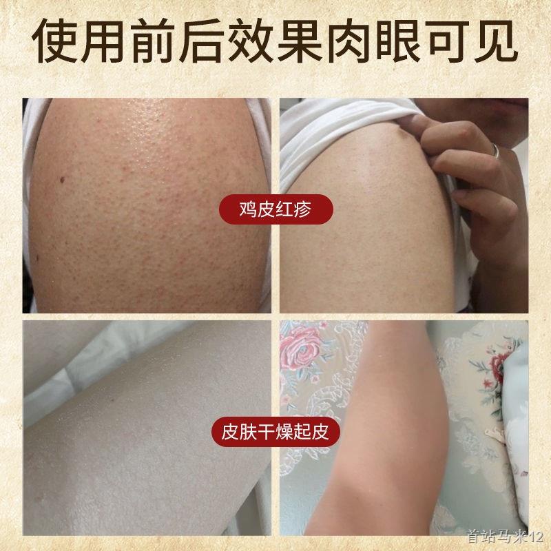 Kem Dưỡng Thể Làm Trắng Da Mùa Đông Dạng Ống Hút Dưỡng Ẩm Loại Bỏ Da Gà Lâu Trôi Có Hương Thơm hl21.10.8 szmalai12.my