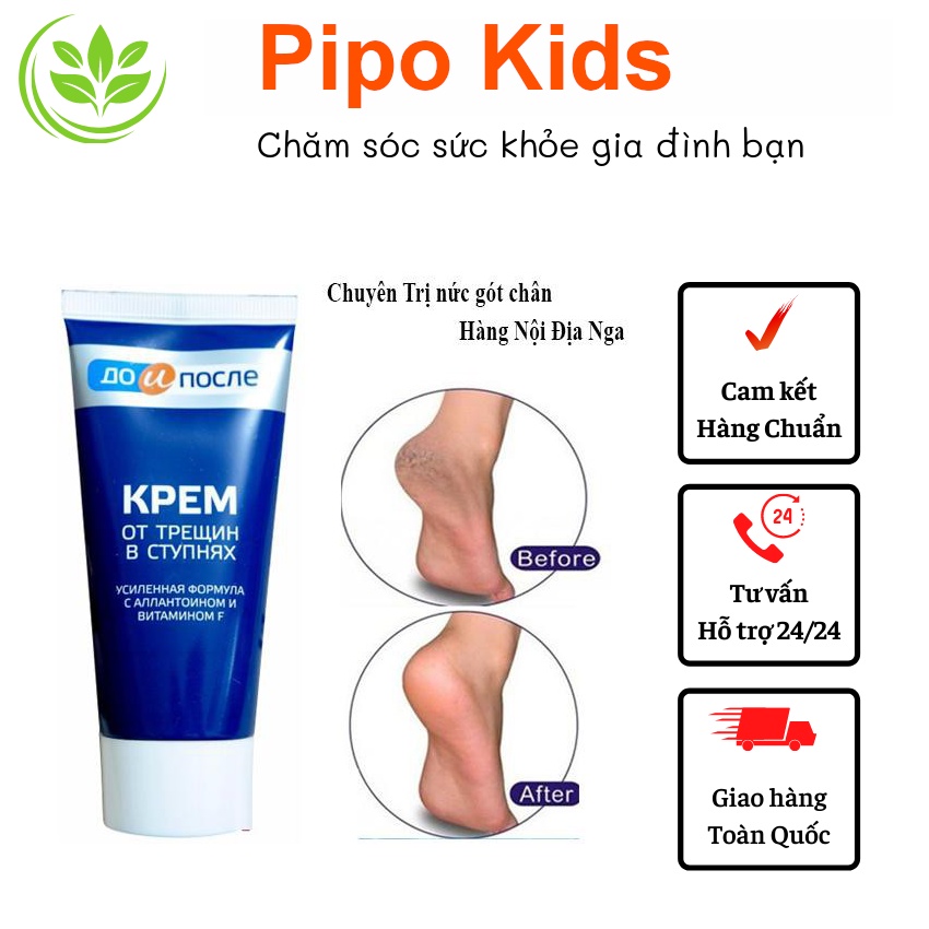 Kem Nứt Gót Chân Kpem Nga 50ml